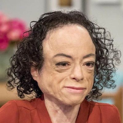 Liz Carr