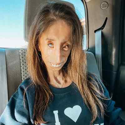 Lizzie Velasquez
